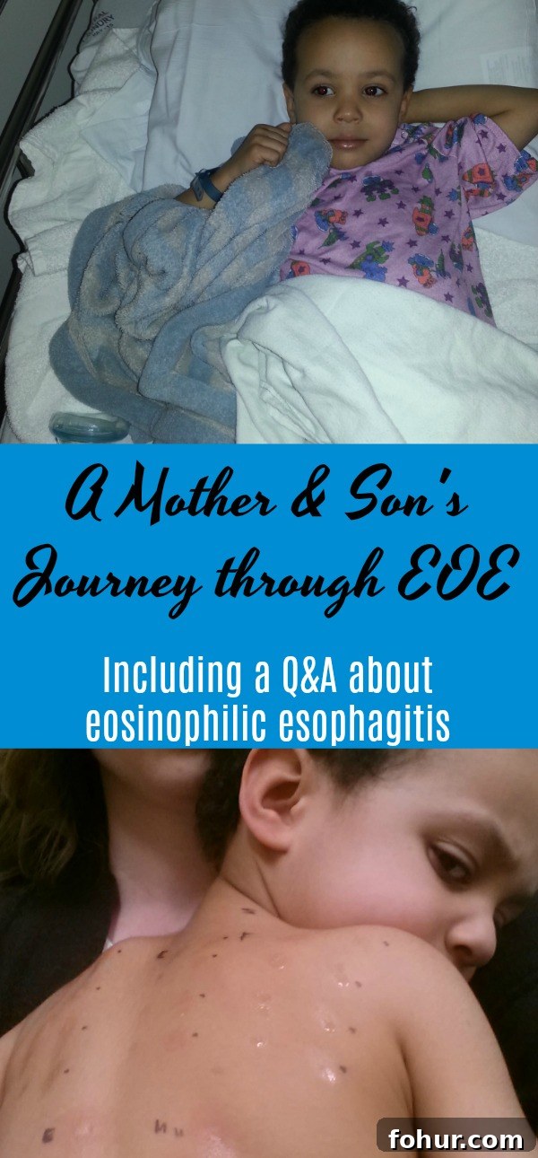 Eosinophilic Esophagitis (EOE): A Mother and Son's Journey 6 eosinophilic esophagitis EOE in kids